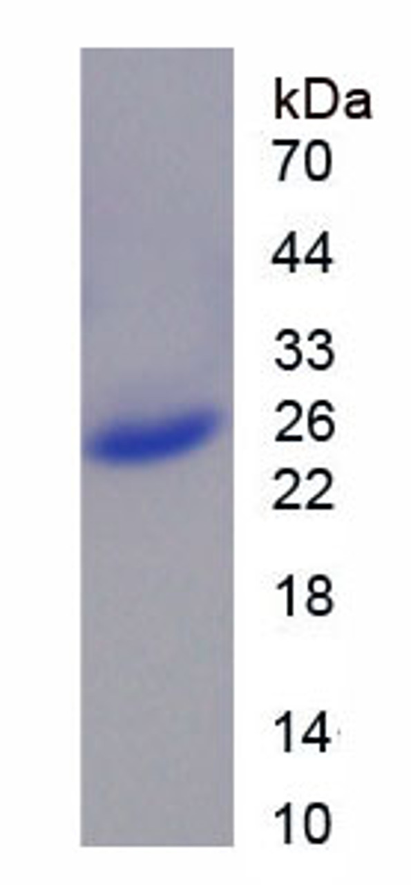 Human Recombinant Casein Beta (CSN2)