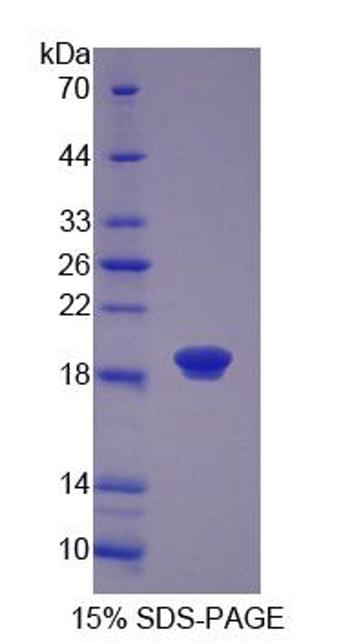 Human Recombinant Coactosin Like Protein 1 (COTL1)