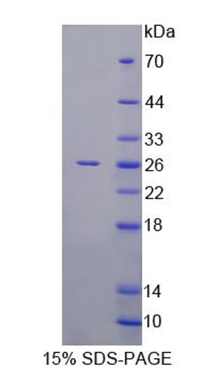 Rat Recombinant Coronin 1A (CORO1A)