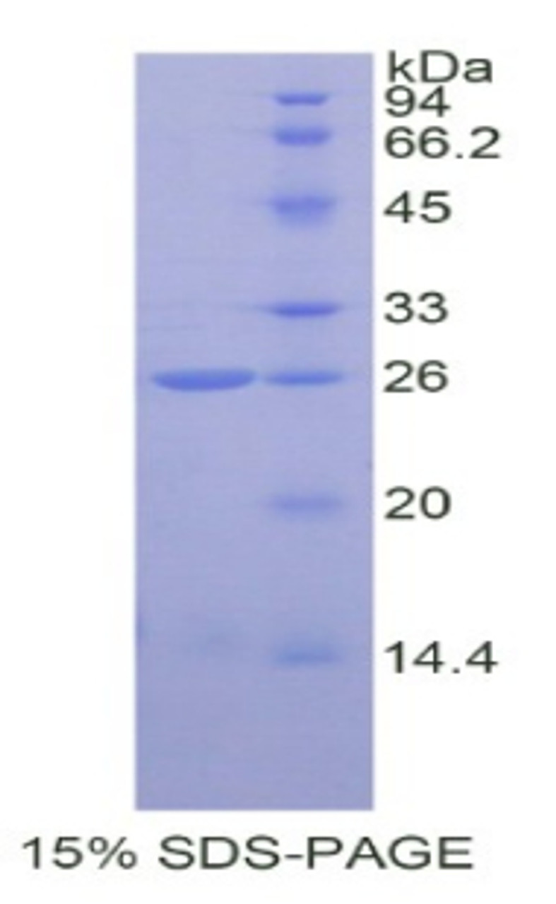 Human Recombinant Catechol-O-Methyltransferase (COMT)