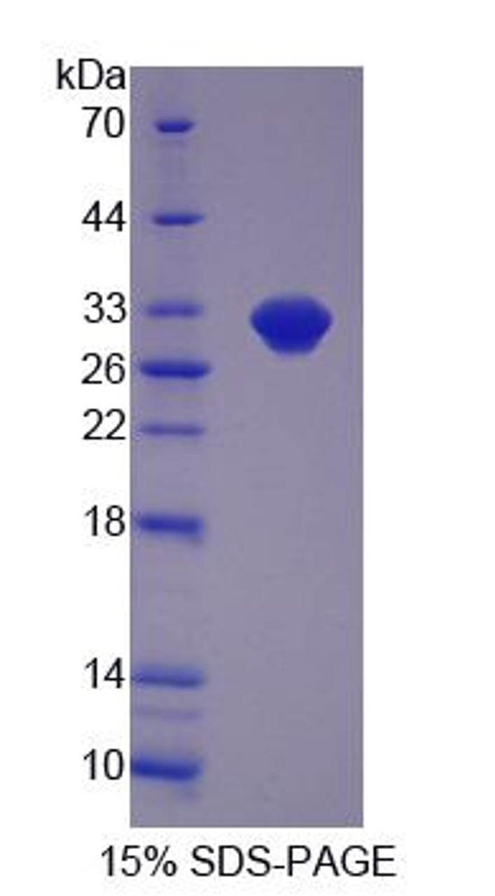 Human Recombinant Lactamase Beta (LACTb)