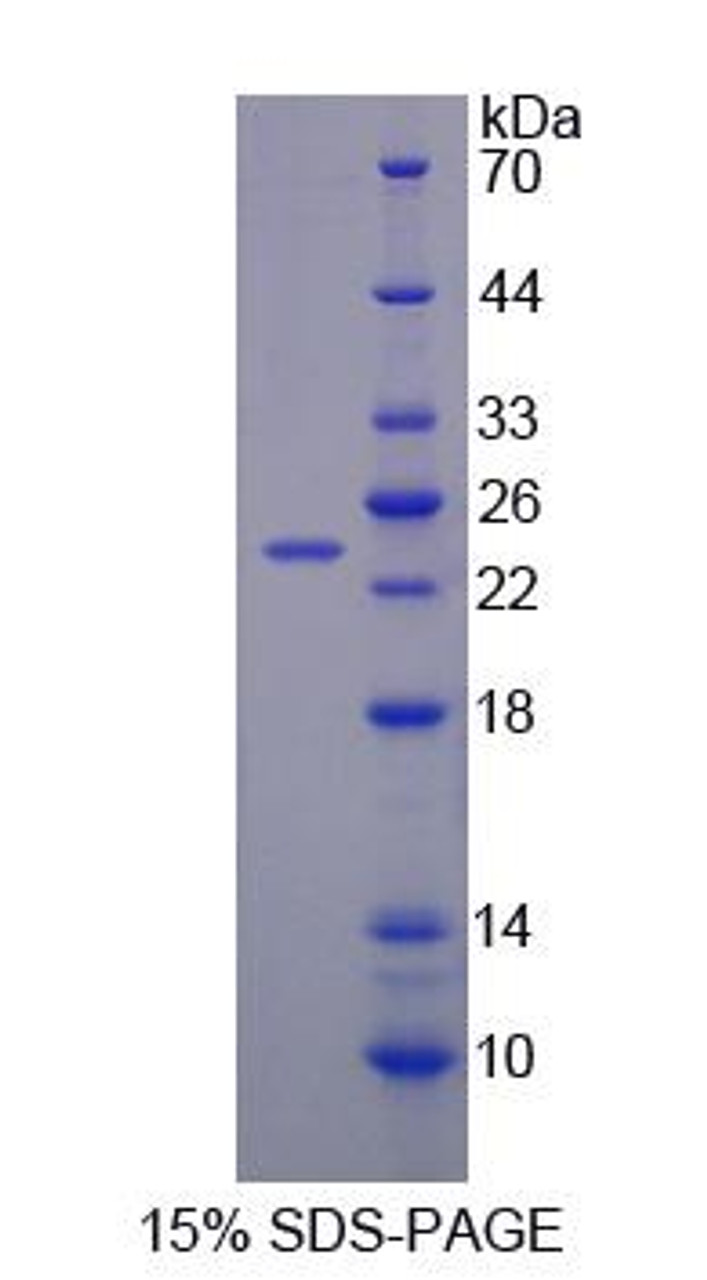 Rat Recombinant Branched Chain Alpha-Ketoacid Dehydrogenase Kinase (BCKDK)