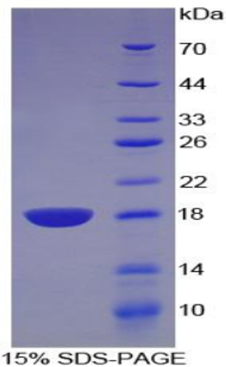 Rat Recombinant Artemin (ARTN)