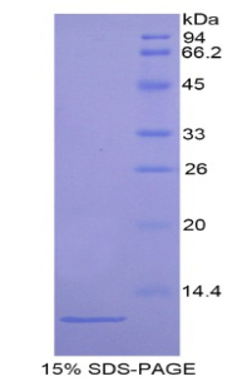 Mouse Recombinant Actin Related Protein 2/3 Complex Subunit 4 (ARPC4)