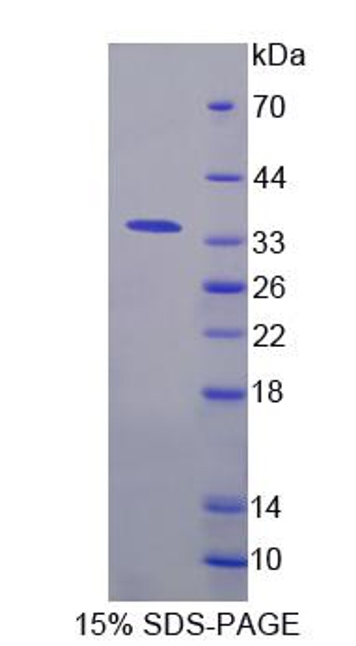 Human Recombinant Acyloxyacyl Hydrolase (AOAH)