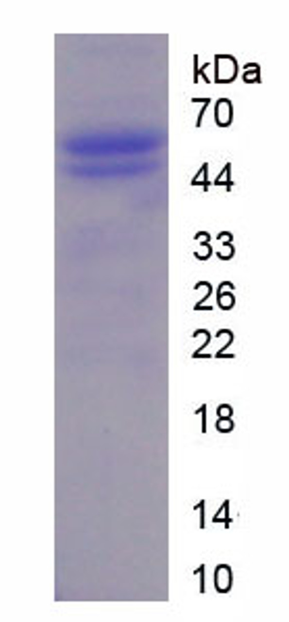 Mouse Recombinant Acidic Nuclear Phosphoprotein 32 Family, Member A (ANP32A)