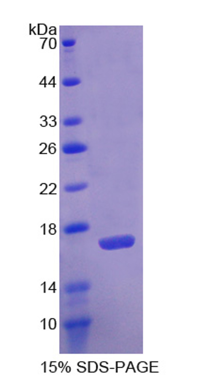 Human Recombinant Agmatine Ureohydrolase (AGMAT)