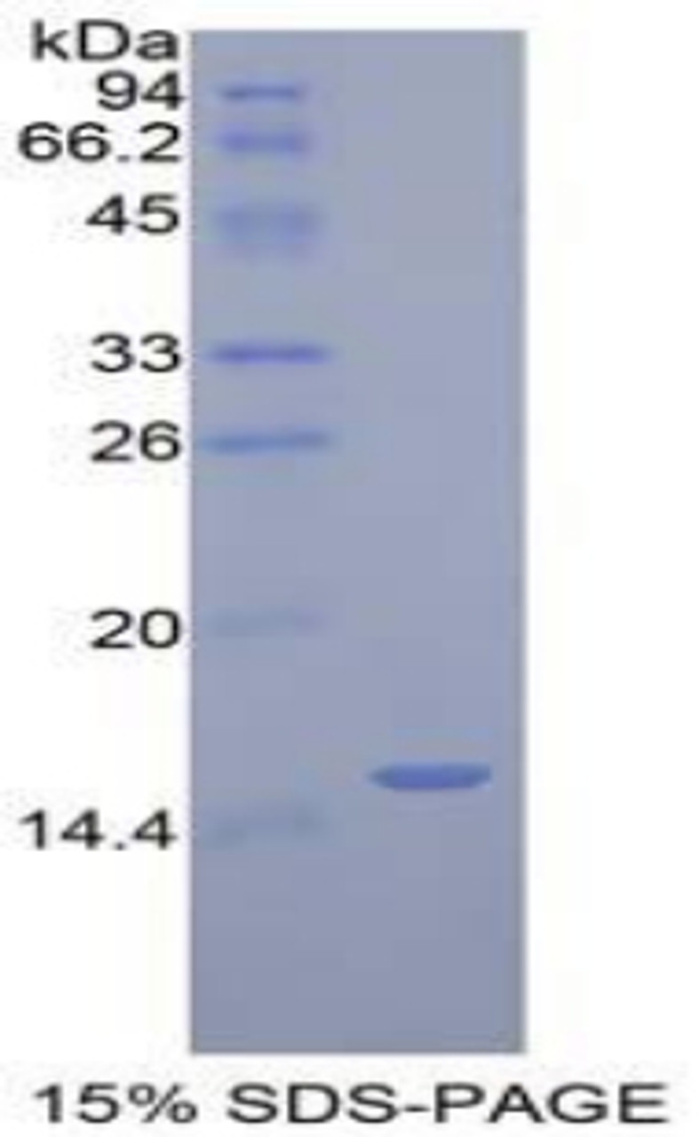 Human Recombinant Golgi Glycoprotein 1 (GLG1)