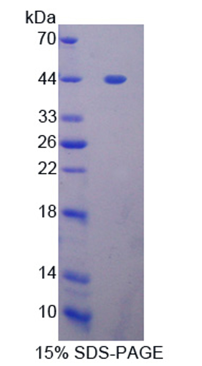 Rat Recombinant GLI Family Zinc Finger Protein 1 (GLI1)