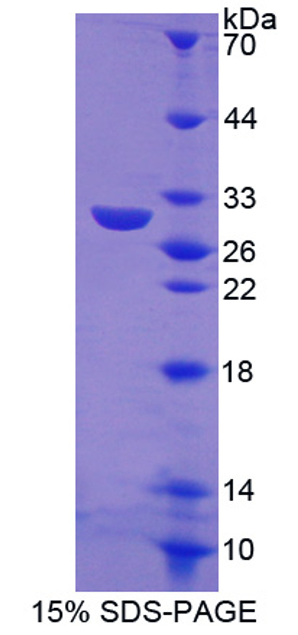 Human Recombinant TRAF Family Member Associated NFKB Activator (TANK)