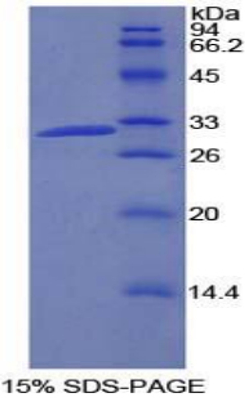 Rat Recombinant Phosphoinositide-3-Kinase Class-2-Beta Polypeptide (PIK3C2b)