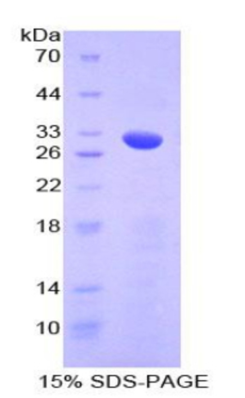 Mouse Recombinant Numb Homolog (NUMB)