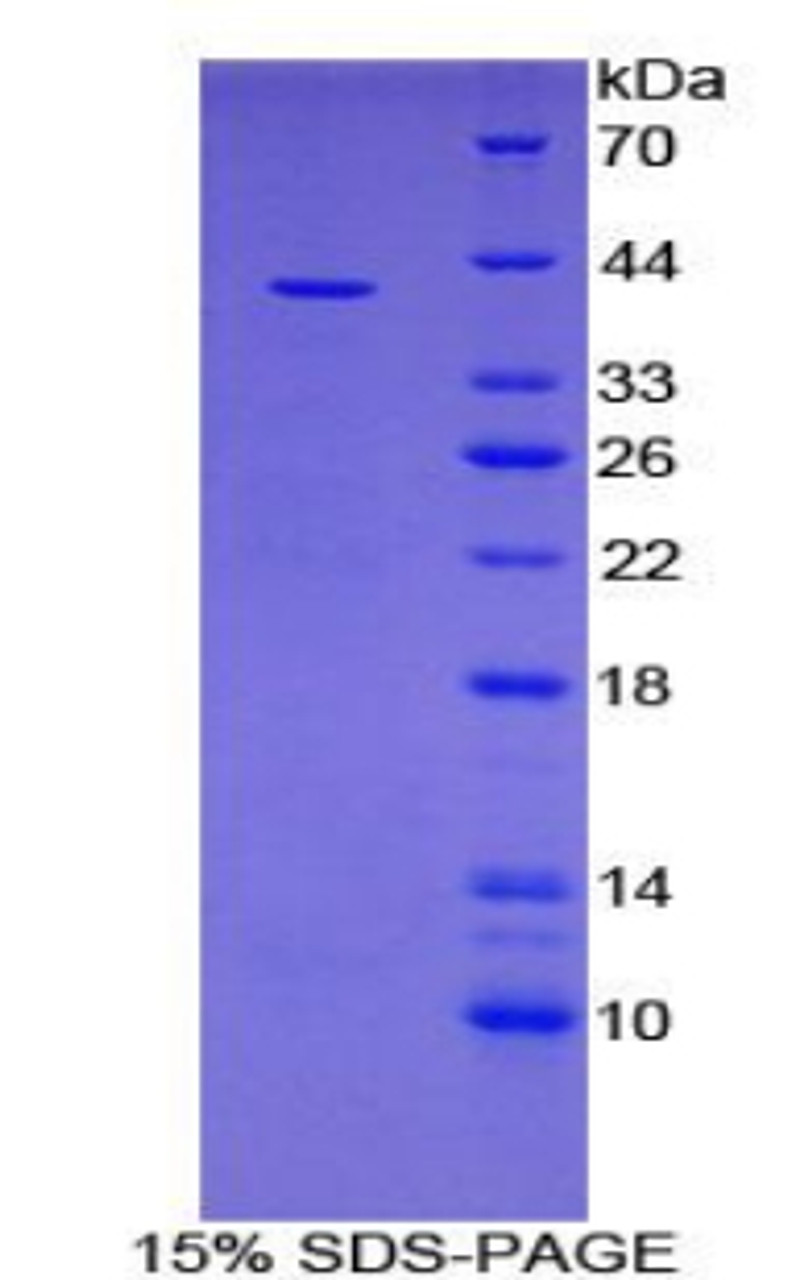 Human Recombinant V-Set Domain Containing T-Cell Activation Inhibitor 1 (VTCN1)