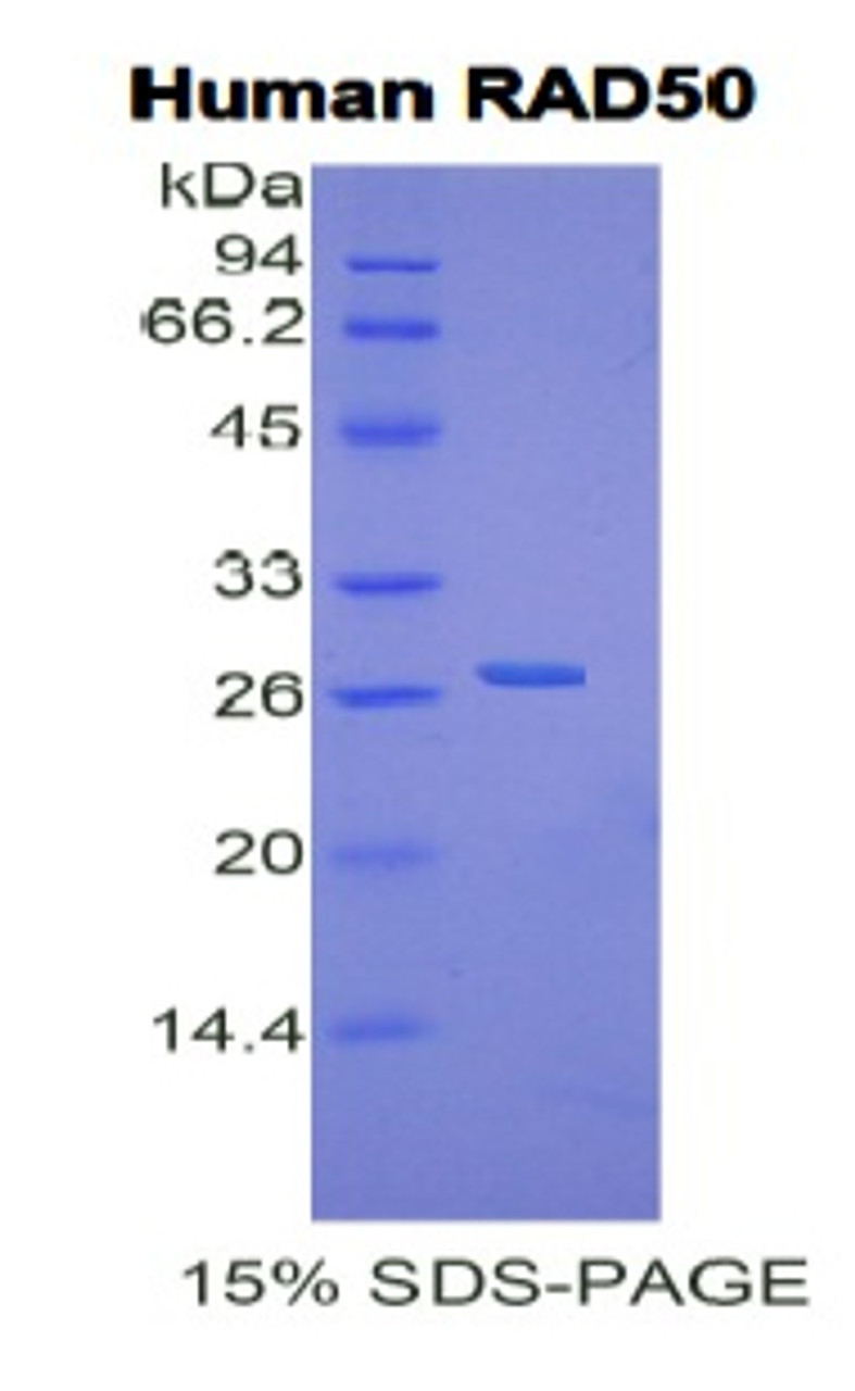 Human Recombinant DNA Repair Protein RAD50 (RAD50)