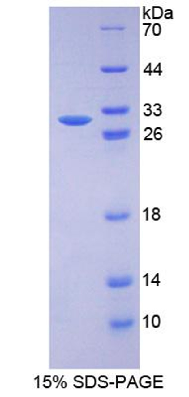 Mouse Recombinant DNA Repair Protein RAD50 (RAD50)