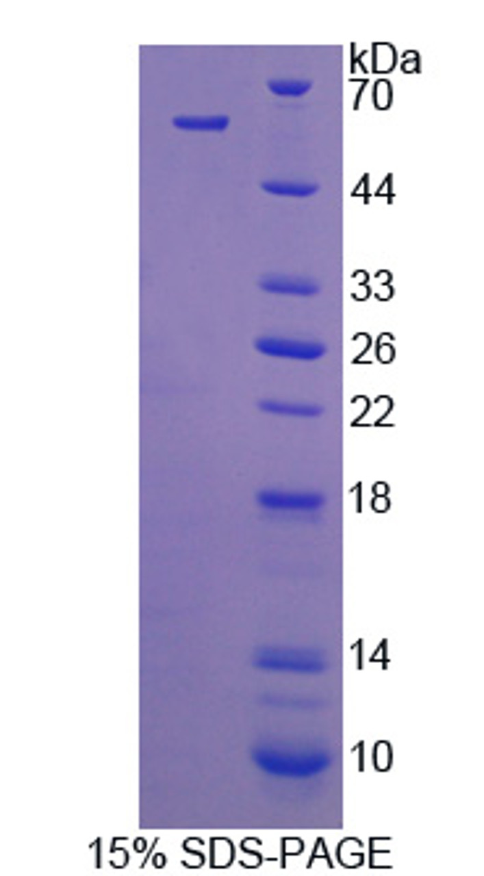 Human Recombinant C1q And Tumor Necrosis Factor Related Protein 1 (C1QTNF1)