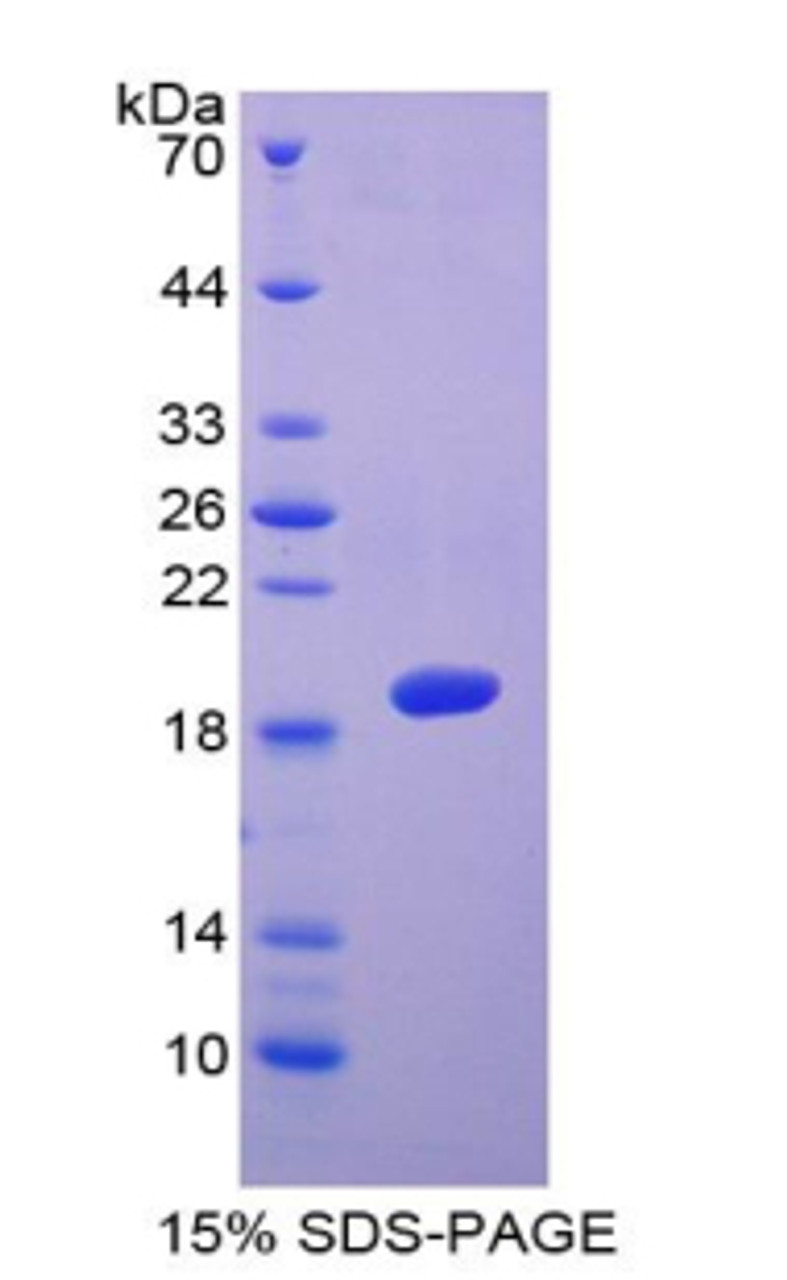 Human Recombinant A Disintegrin And Metalloproteinase With Thrombospondin 5 (ADAMTS5)