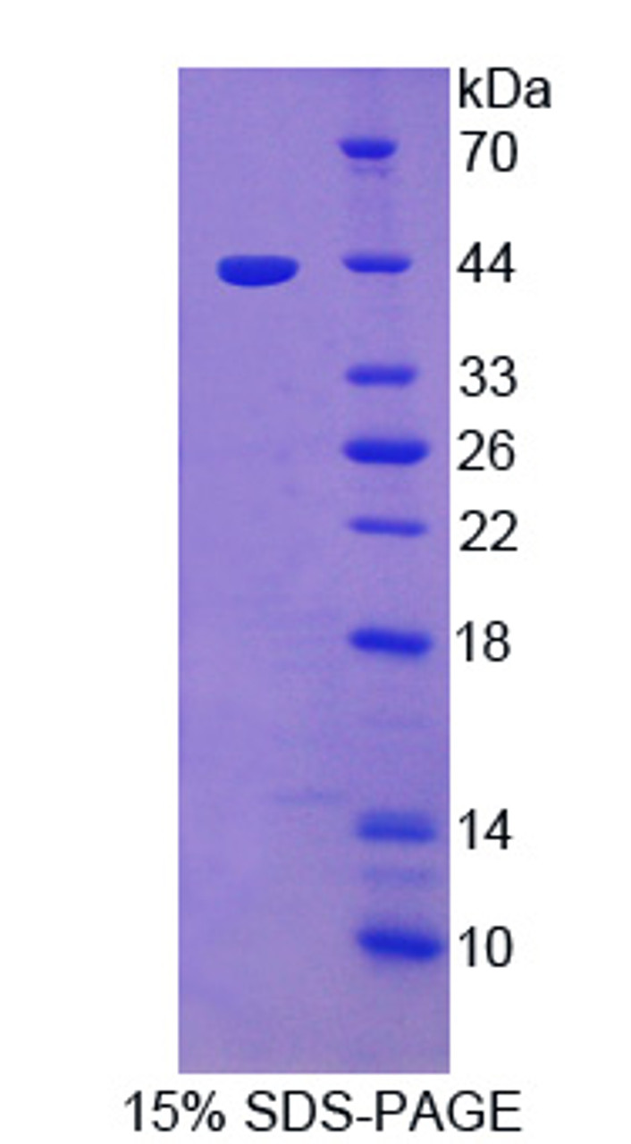 Rat Recombinant A Disintegrin And Metalloproteinase With ThrombosPondin 5 (ADAMTS5)