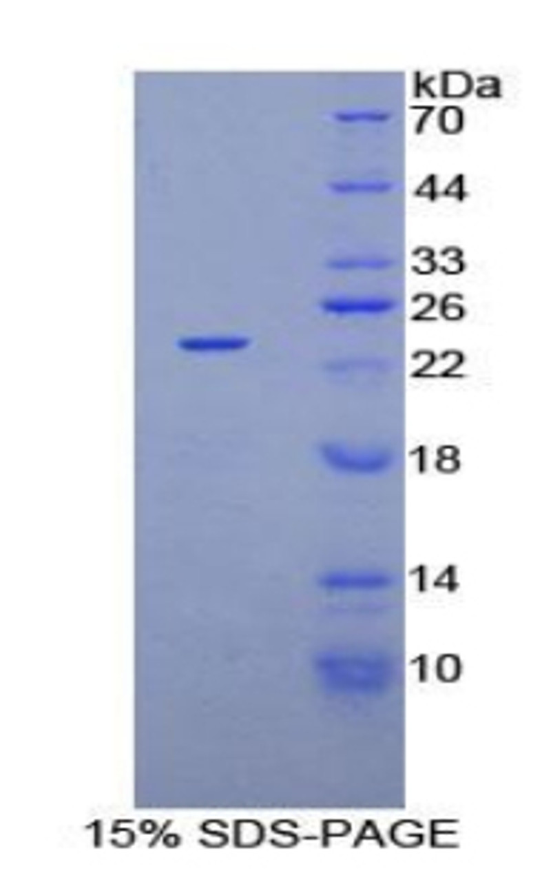 Human Recombinant Non Metastatic Cells 3, Protein NM23A Expressed In (NME3)