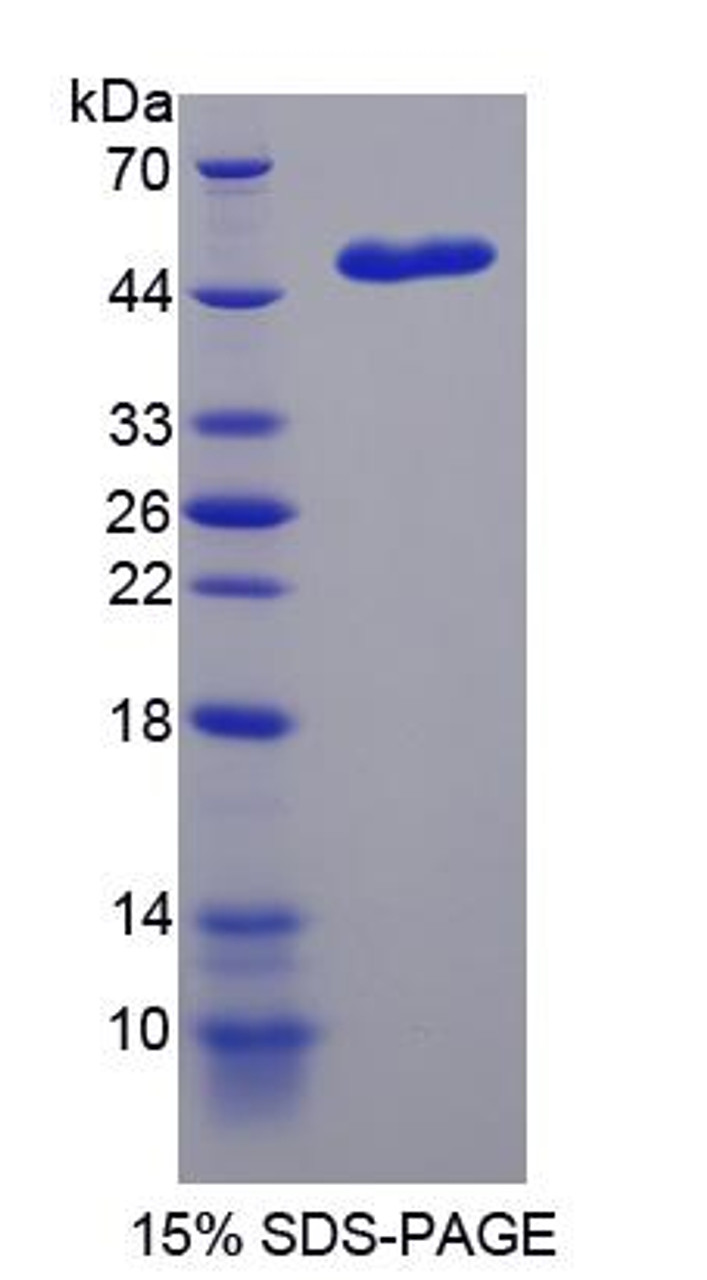 Human Recombinant Non Metastatic Cells 5, Protein NM23A Expressed In (NME5)