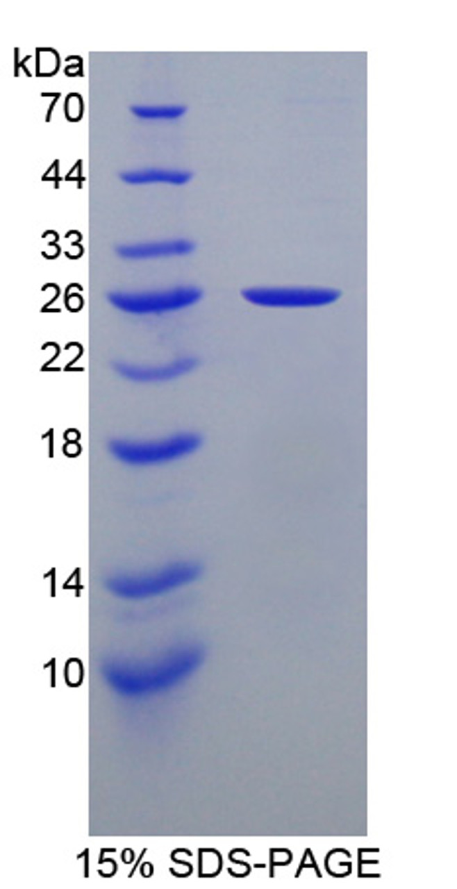 Mouse Recombinant Non Metastatic Cells 5, Protein NM23A Expressed In (NME5)