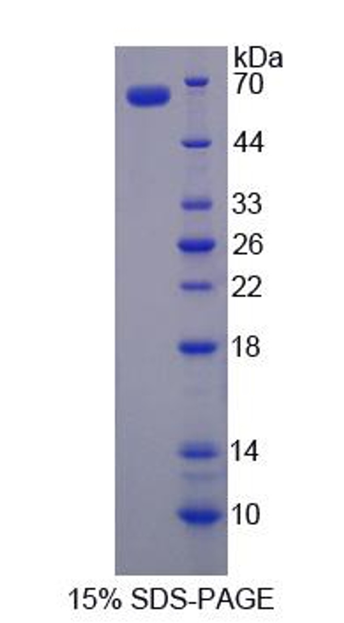 Human Recombinant FYN Oncogene Related To SRC/FGR/YES (FYN)