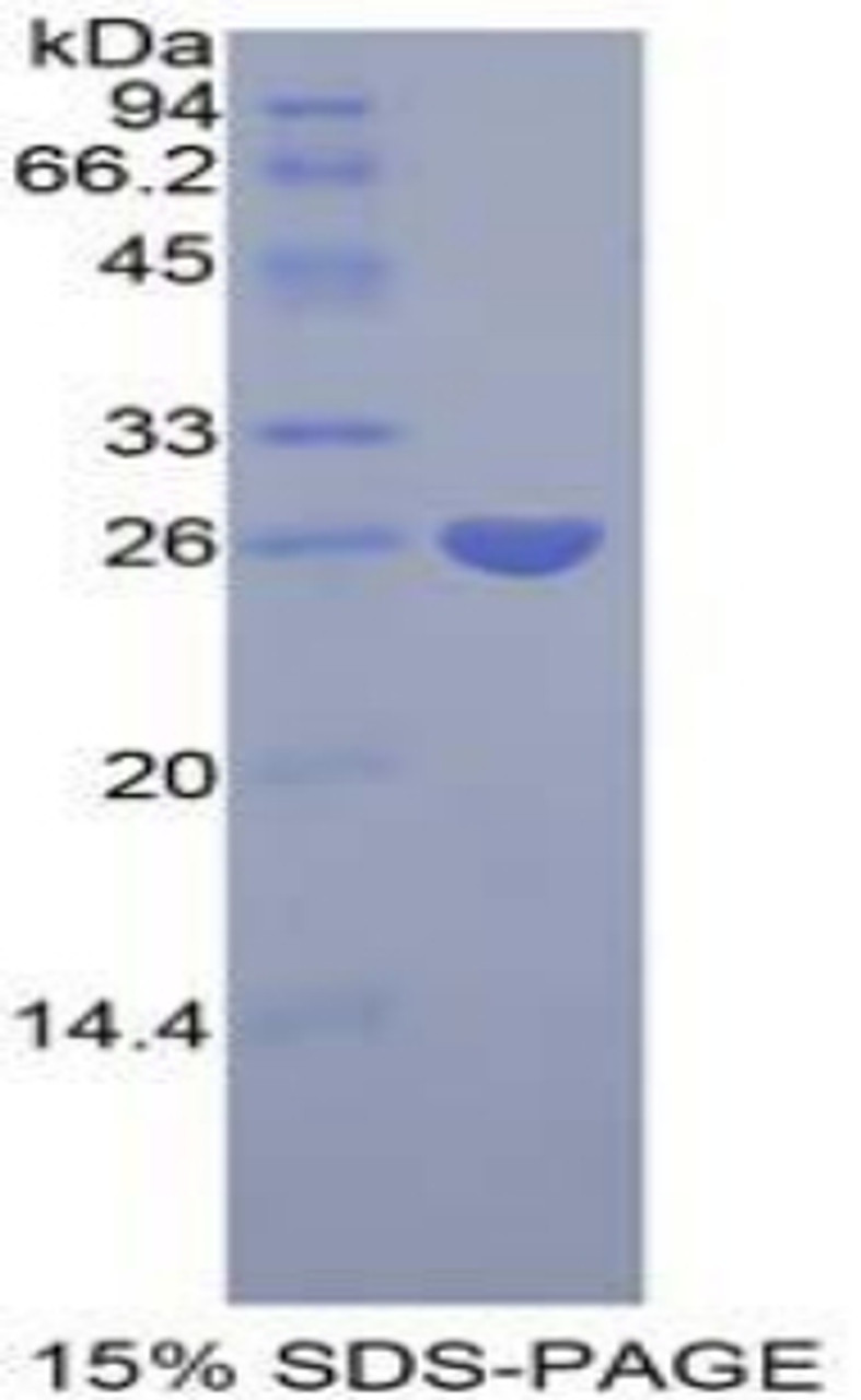 Human Recombinant Pentraxin 3, Long (PTX3)