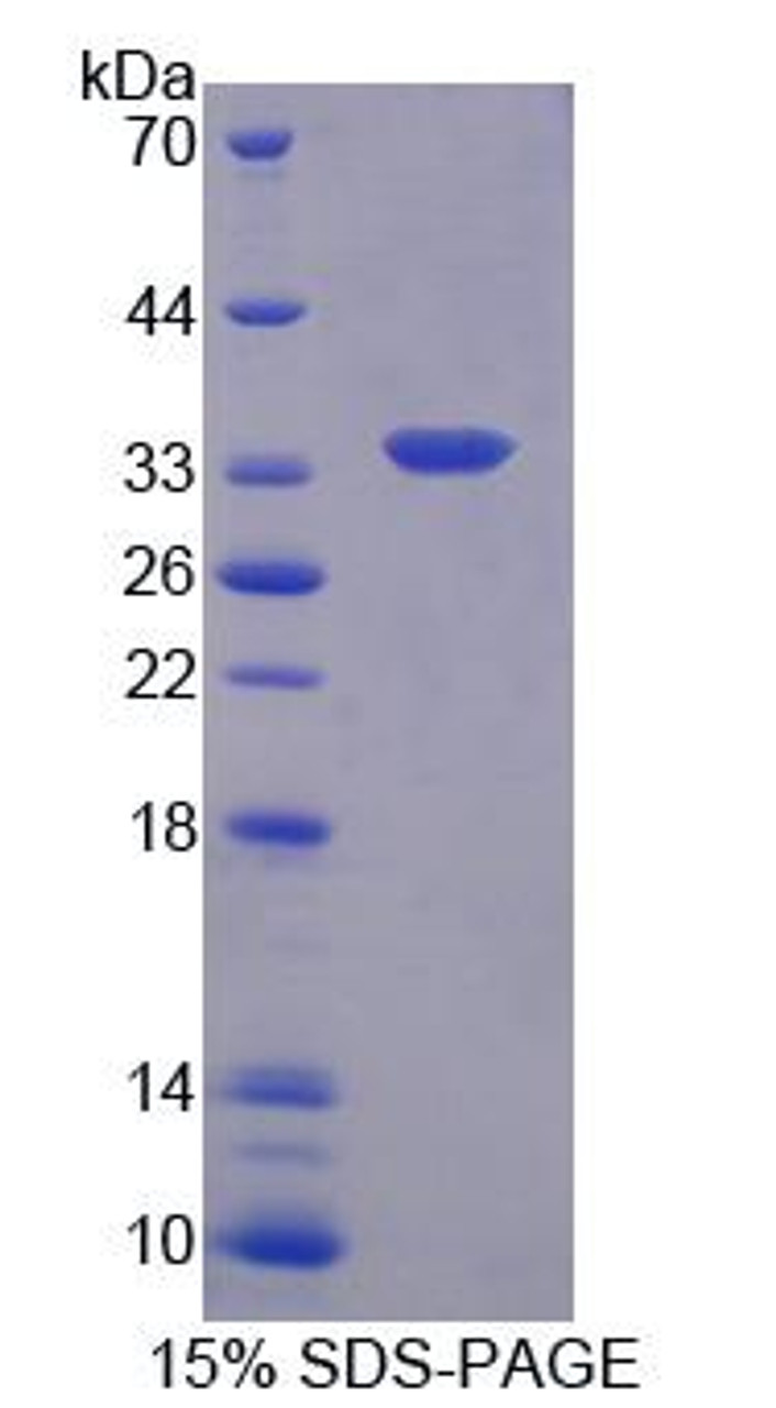 Human Recombinant CKLF Like MARVEL Transmembrane Domain Containing Protein 1 (CMTM1)