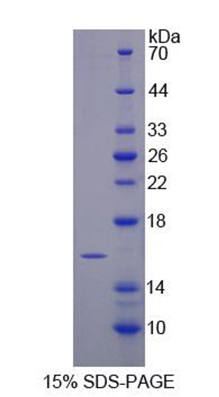 Mouse Recombinant Transmembrane Protein 27 (TMEM27)