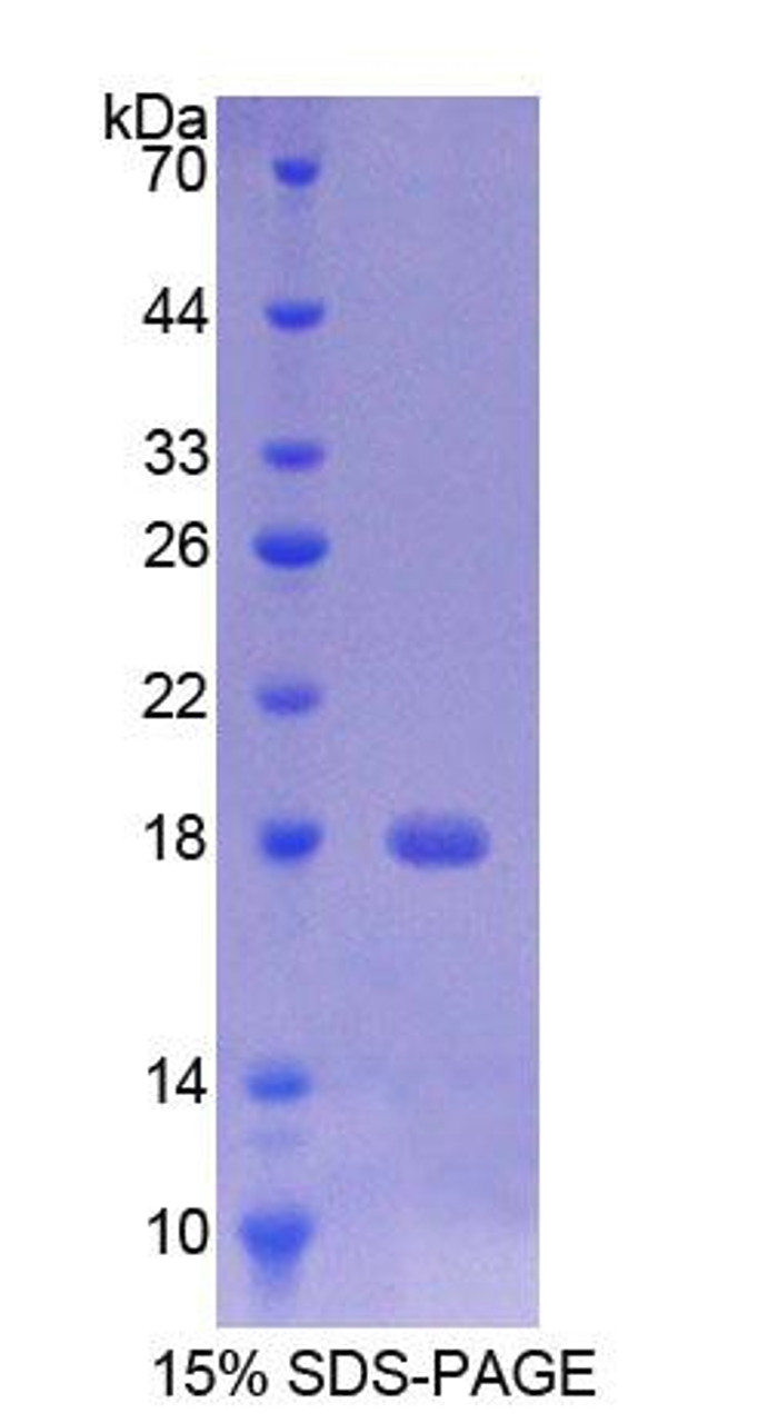 Rat Recombinant Transmembrane Protein 27 (TMEM27)