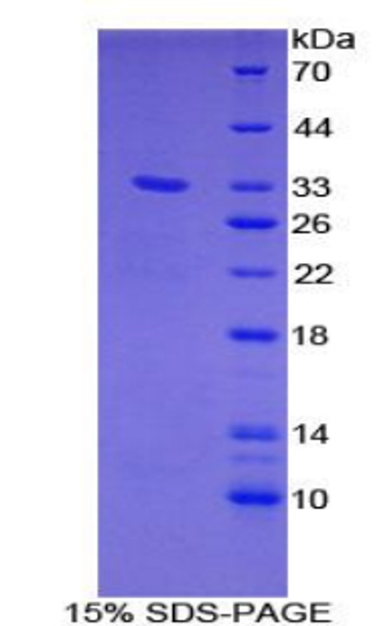 Human Recombinant GRB2 Associated Binding Protein 1 (GAB1)