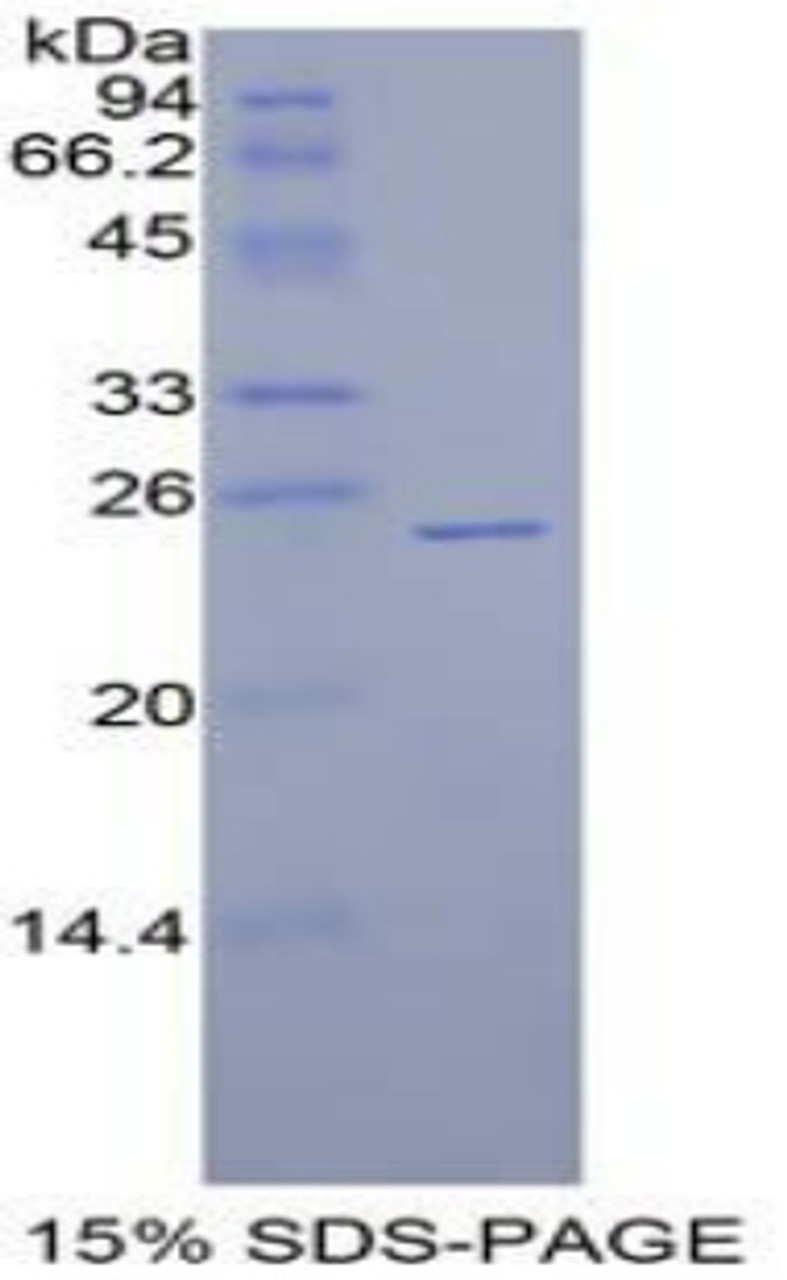 Human Recombinant Sprouty Homolog 1 (SPRY1)