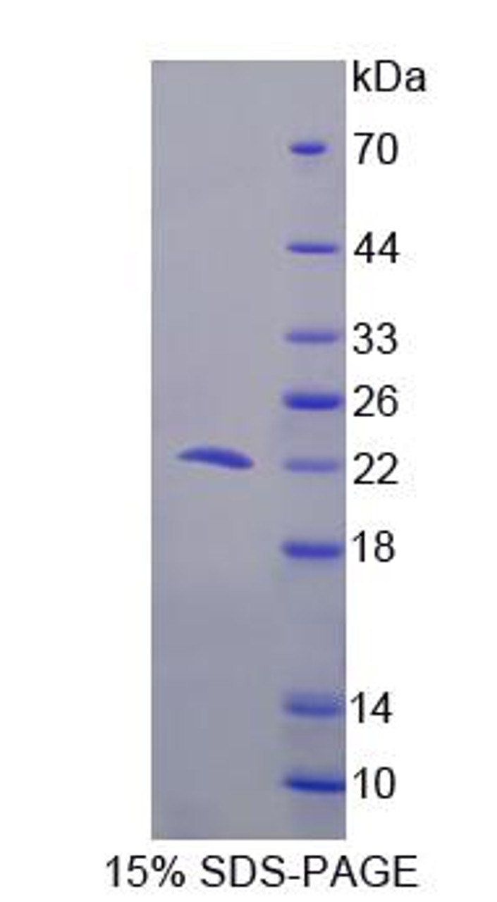 Human Recombinant Programmed Cell Death Protein 6 (PDCD6)