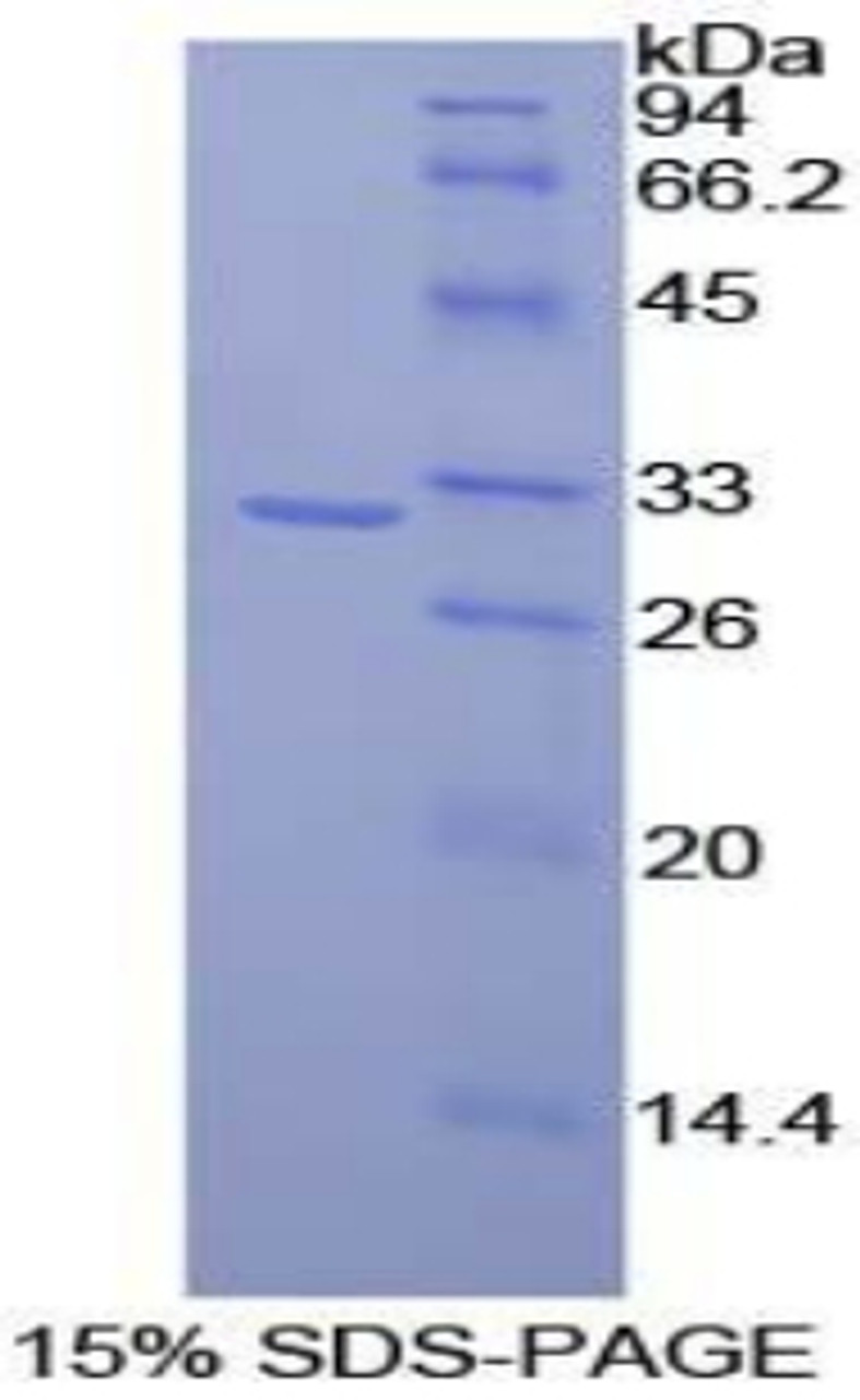 Rat Recombinant CD2 Associated Protein (CD2AP)