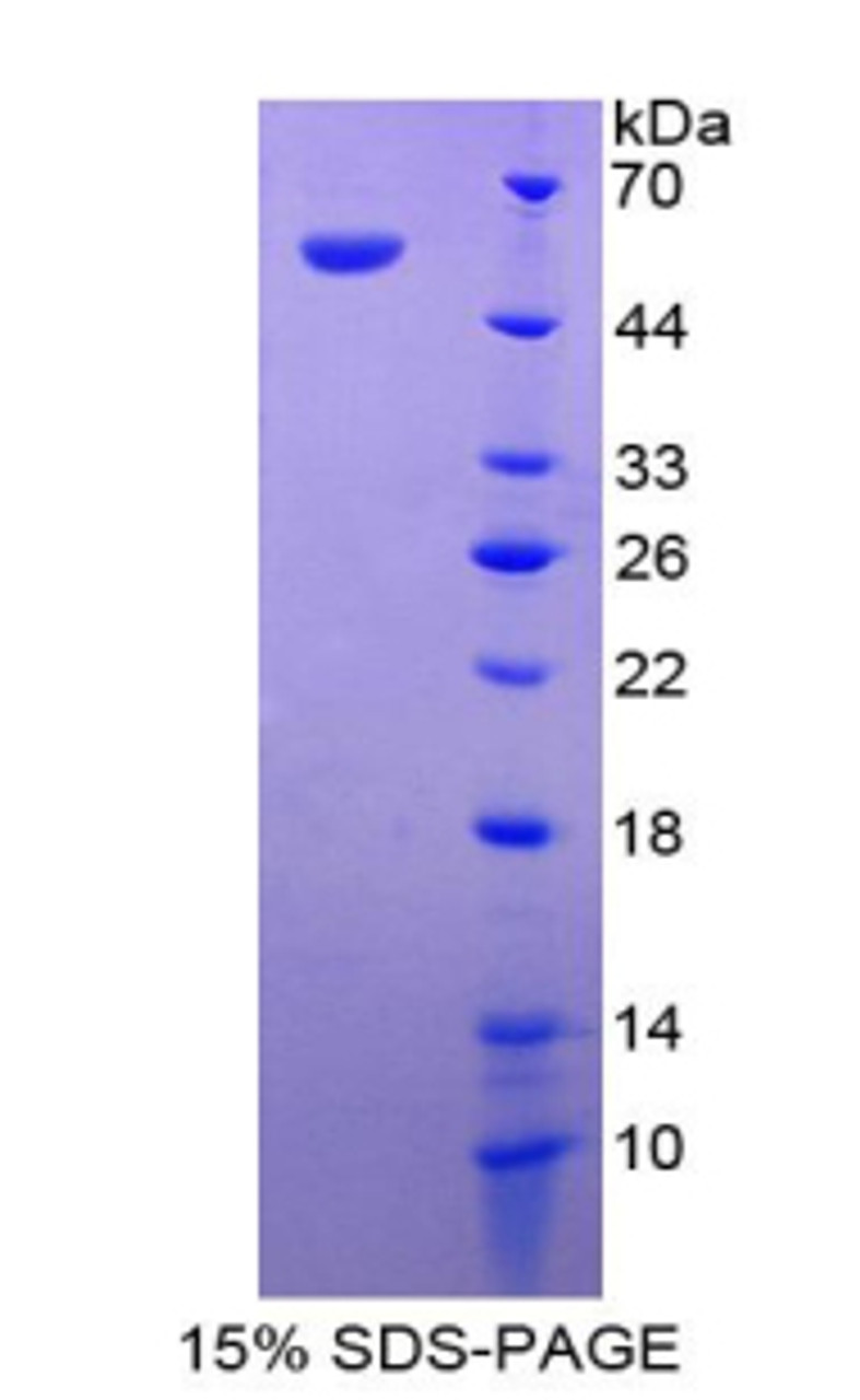 Human Recombinant Cell Death Inducing DFFA Like Effector A (CIDEA)