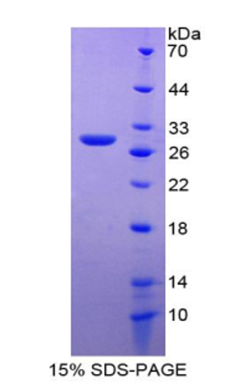 Rat Recombinant Delta Like 1 Homolog (dLK1)