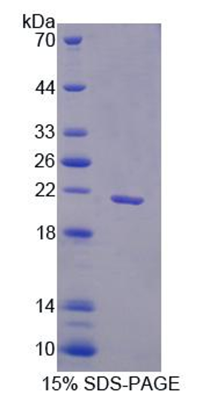 Human Recombinant Family With Sequence Similarity 3, Member B (FAM3B)