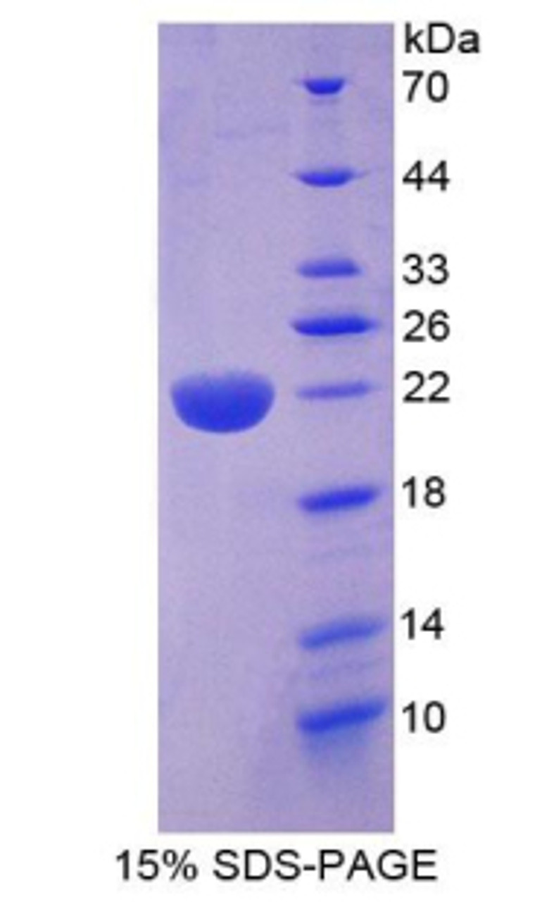 Human Recombinant Growth Arrest And DNA Damage Inducible Protein Beta (GADD45b)