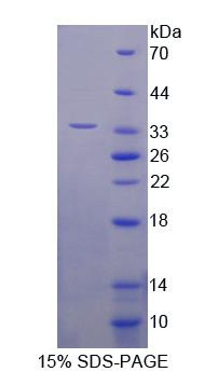 Mouse Recombinant Hermansky Pudlak Syndrome Protein 1 (HPS1)