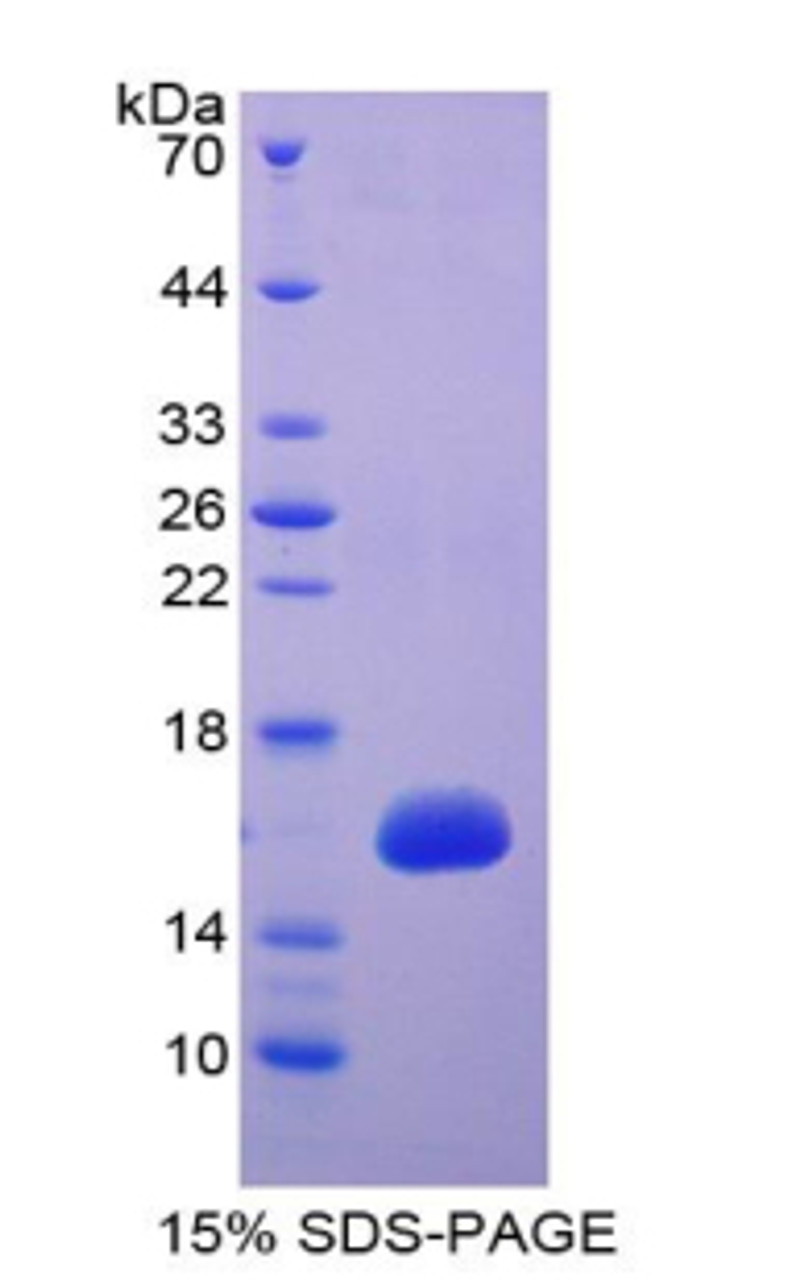 E.coli Recombinant HtrA Serine Peptidase 1 (HTRA1)