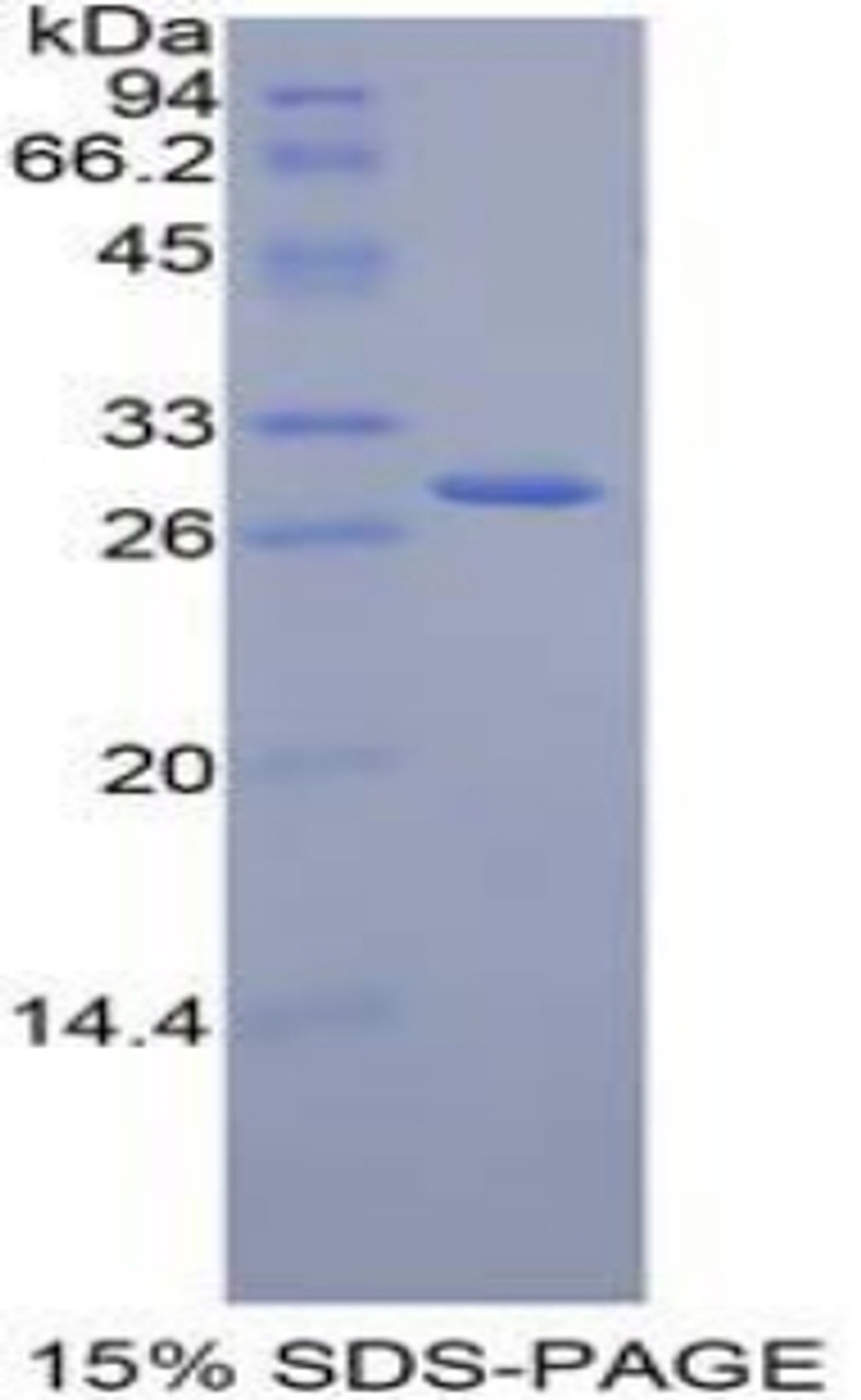 Mouse Recombinant Jagged 2 Protein (JAG2)