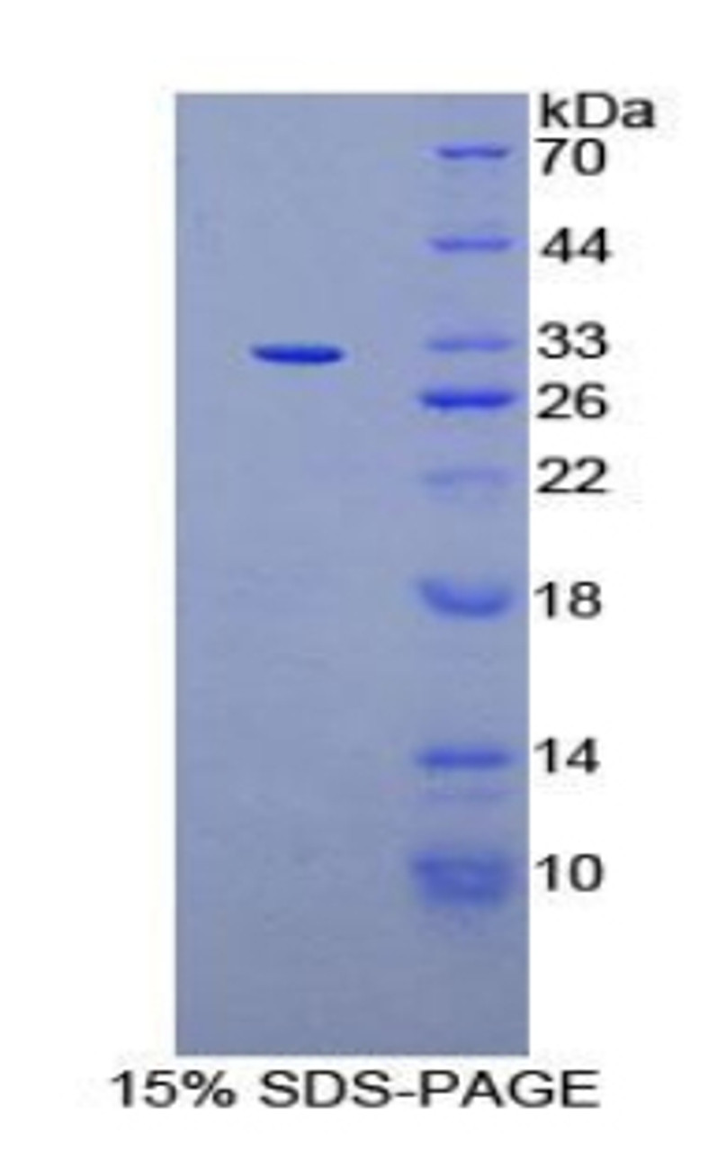 Rat Recombinant Mindbomb Homolog 2 (MIB2)