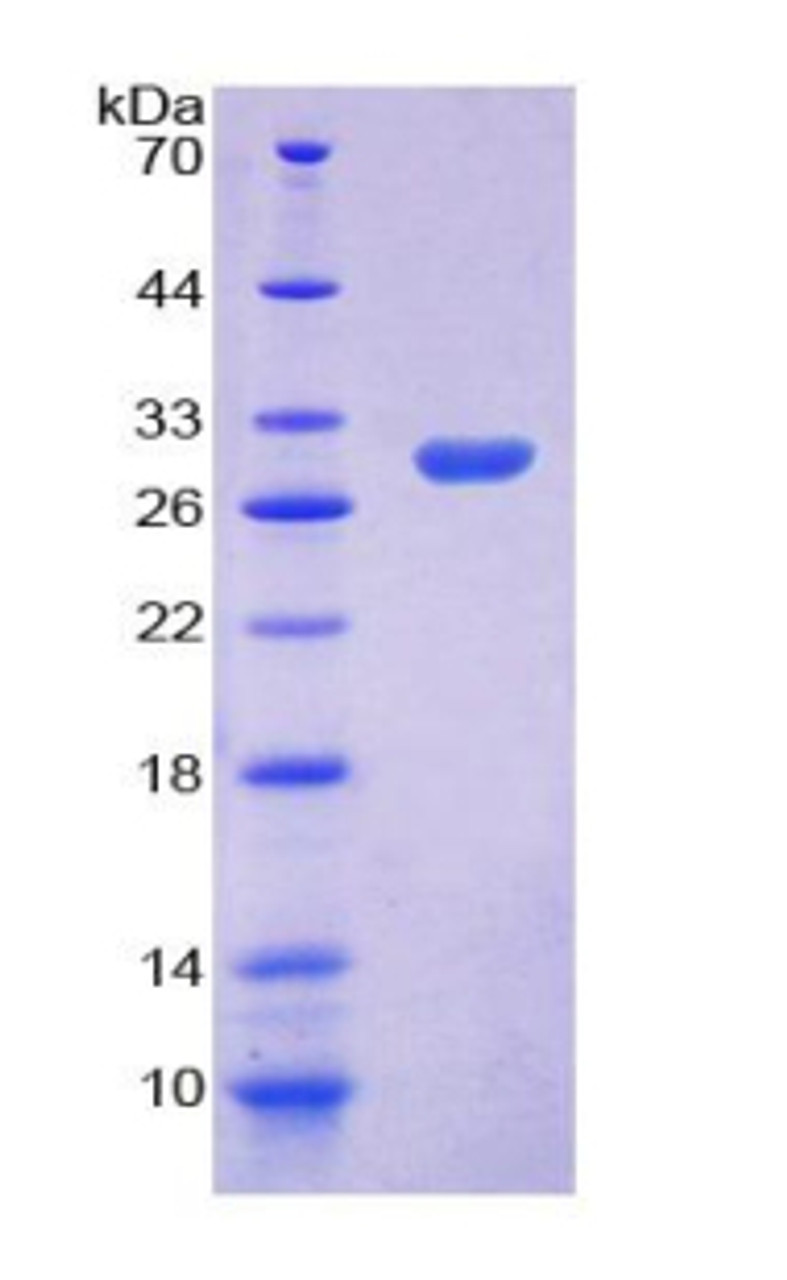 Rat Recombinant Myxovirus Resistance 1 (MX1)