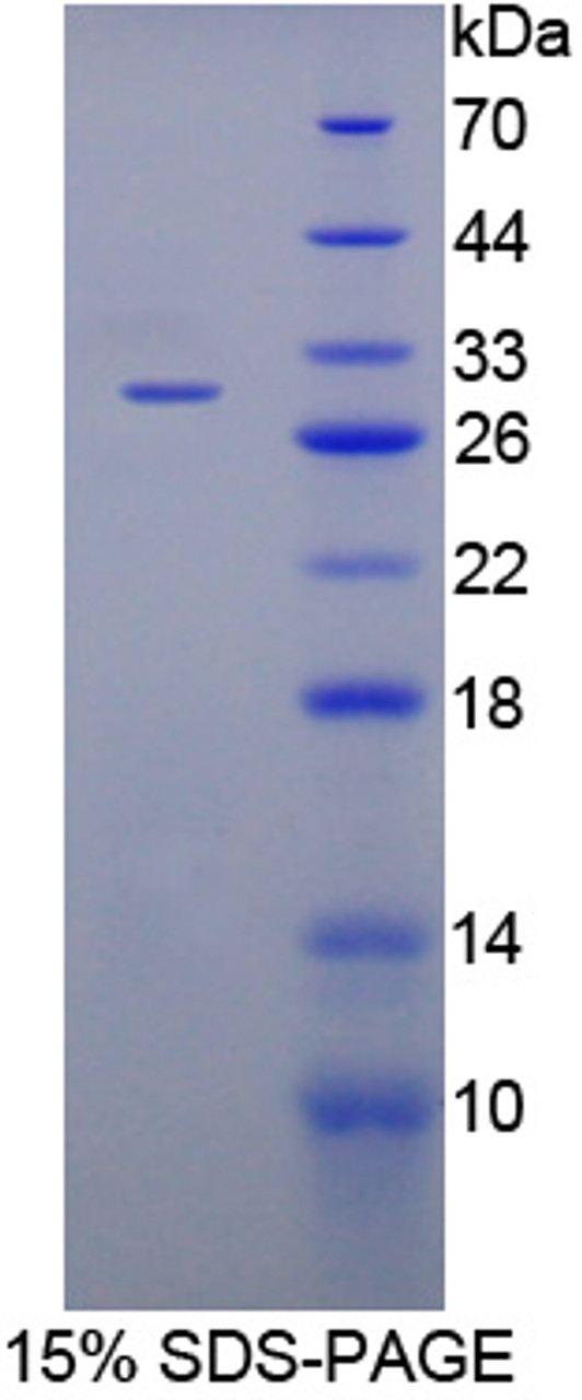 Mouse Recombinant Upregulator Of Cell Proliferation (URGCP)