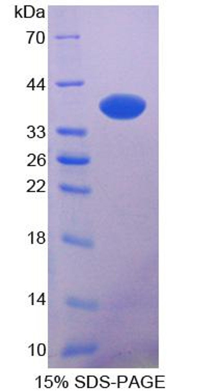 Rat Recombinant N-myc Downstream Regulated Gene 2 (NDRG2)