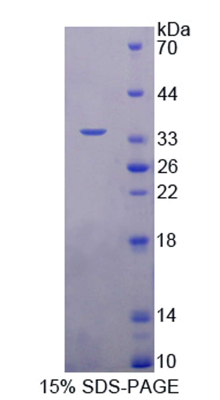 Human Recombinant Nei Endonuclease VIII Like Protein 1 (NEIL1)