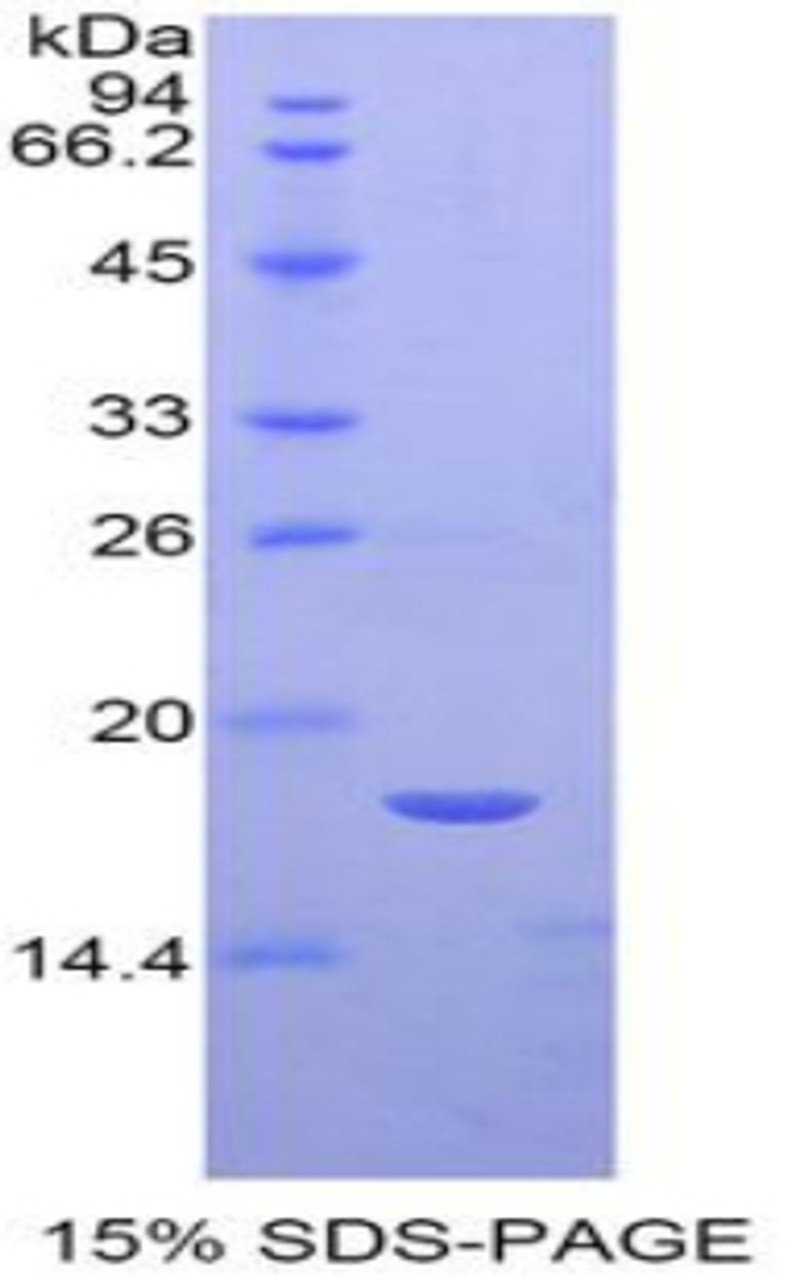 Mouse Recombinant Semaphorin 3A (SEMA3A)