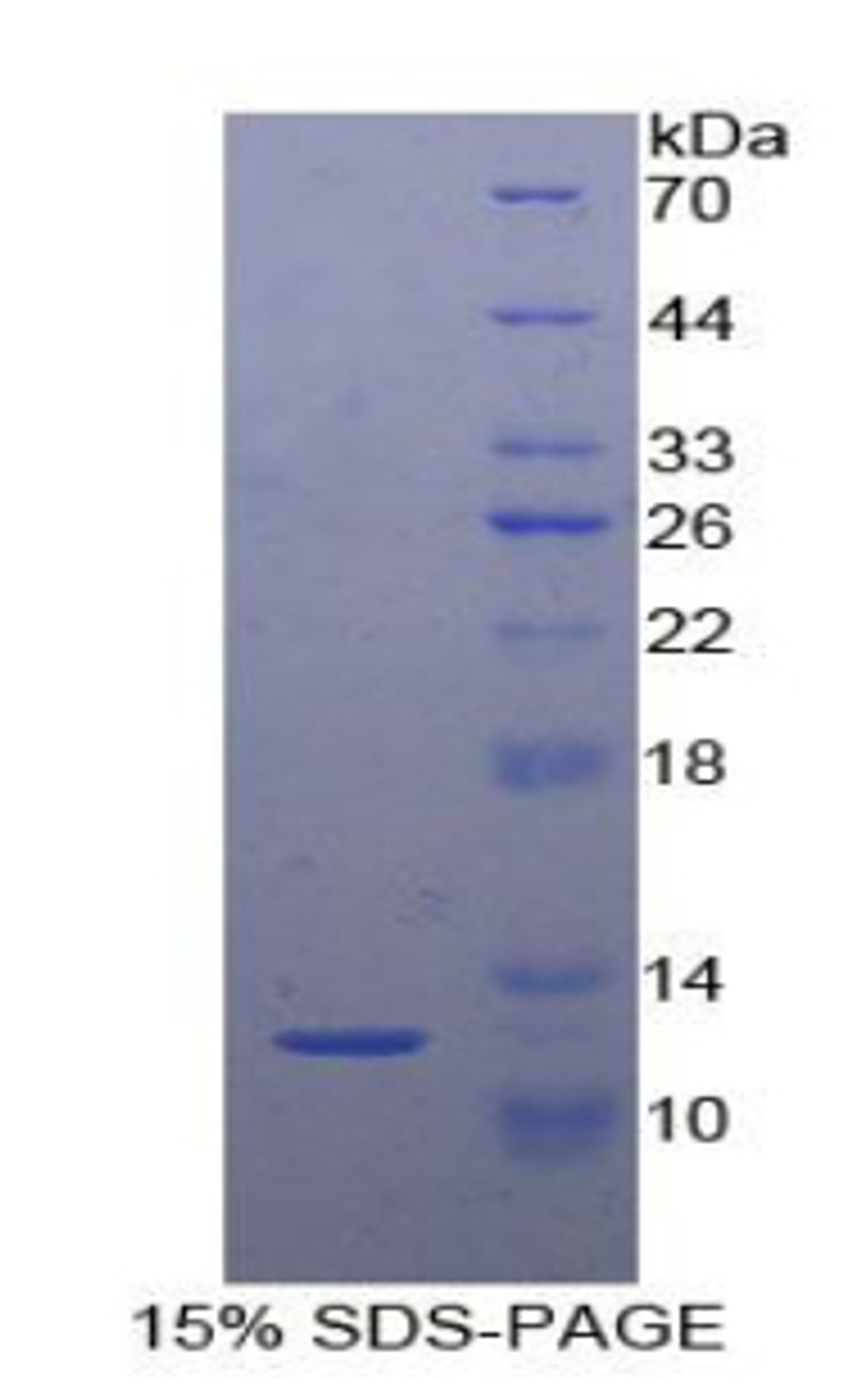 Chicken Recombinant Semaphorin 3E (SEMA3E)