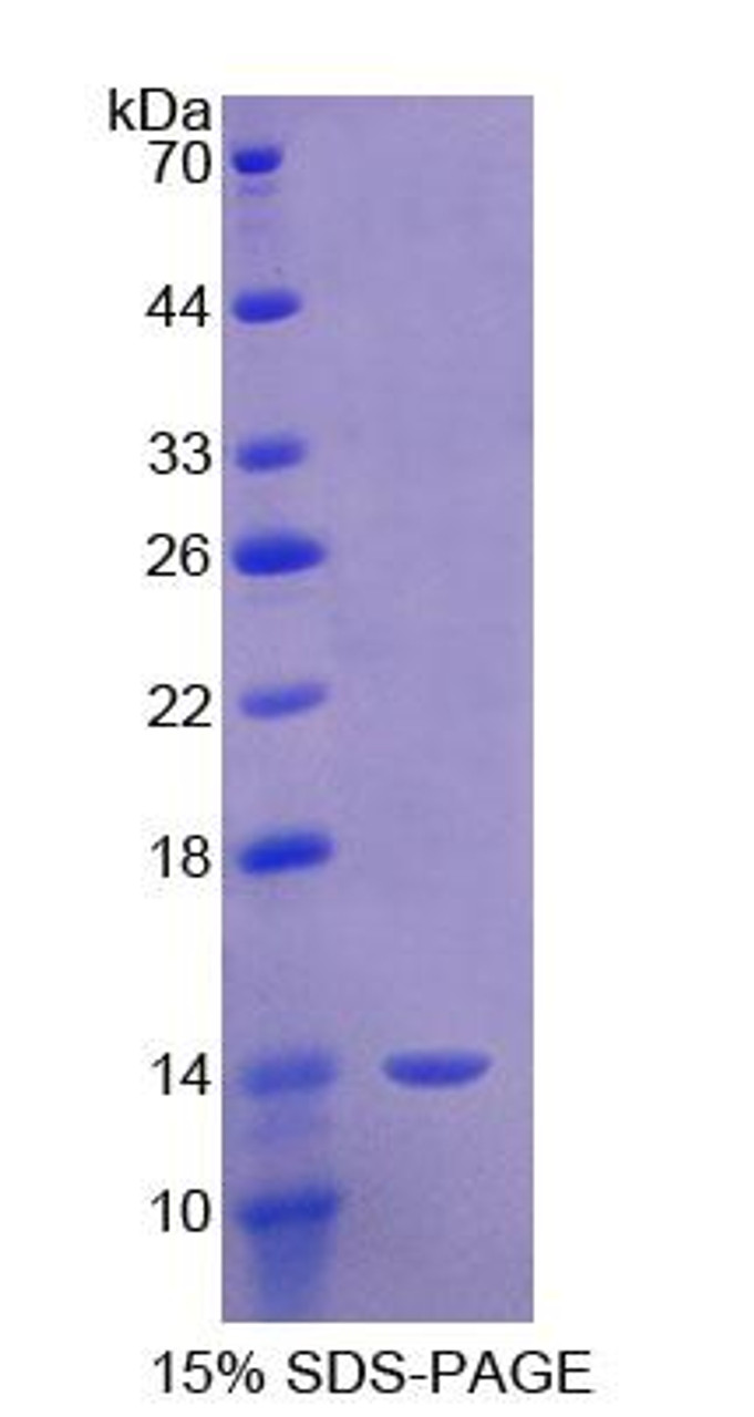 Mouse Recombinant Semaphorin 3E (SEMA3E)