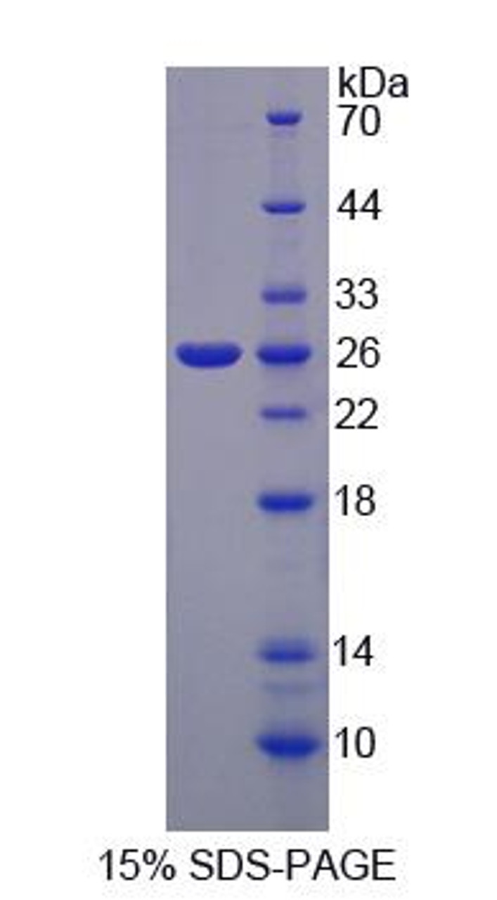 Human Recombinant Nuclear Factor Of Activated T-Cells, Cytoplasmic 2 (NFATC2)